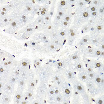 Immunohistochemistry - HNRNPR antibody (144-05883)