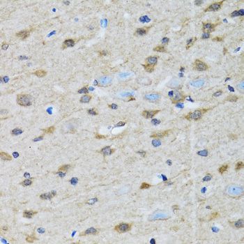 Immunohistochemistry - GOLM1 Polyclonal Antibody (144-07283)