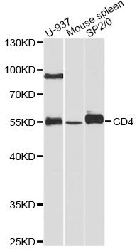 Western blot - CD4 Polyclonal Antibody (144-60019)