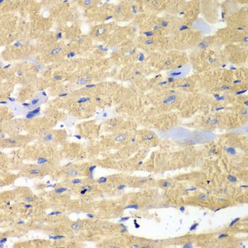 Western blot - HAX1 Polyclonal Antibody (144-05551)