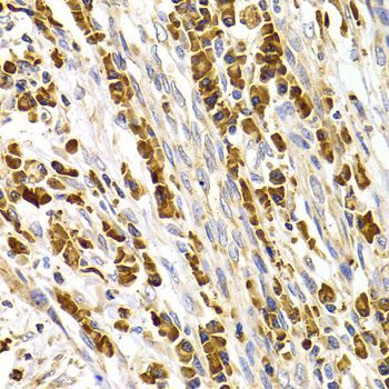 Immunohistochemistry - TACR3 antibody (144-07220)