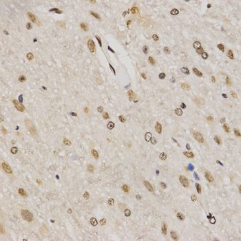 Immunohistochemistry - TriMethyl-Histone H3-K79 pAb (144-61342)