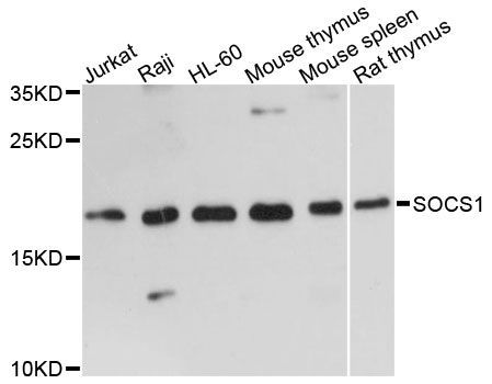 Western blot - SOCS1 antibody (144-07754)