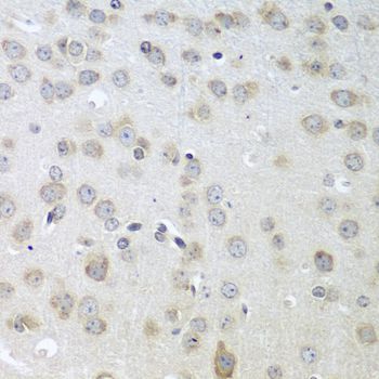 Immunohistochemistry - ACHE antibody (144-02806)