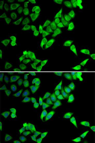 Immunofluorescence - TRIP10 antibody (144-07038)