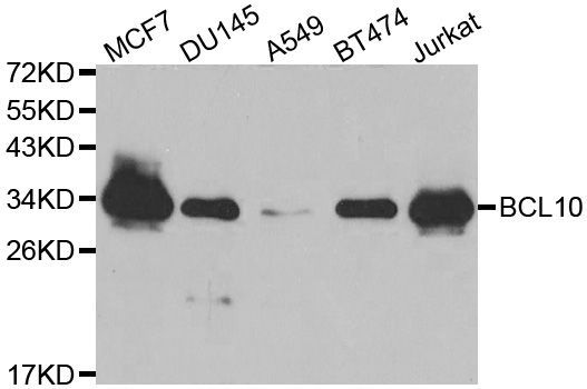 Western blot - [KO Validated] BCL10 Polyclonal Antibody (144-01106)