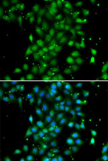 Immunofluorescence - UBE2Z Polyclonal Antibody (144-07225)