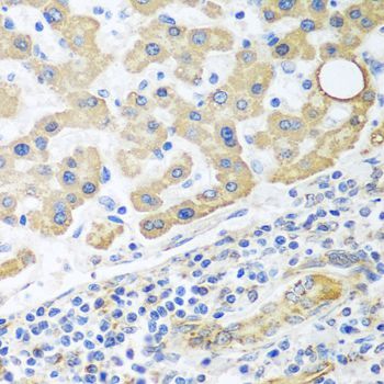 Immunohistochemistry - GLUD1 antibody (144-07631)