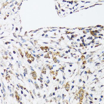 Immunohistochemistry - DHRS2 antibody (144-06446)