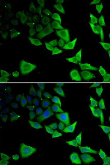 Immunofluorescence - SNCA Polyclonal Antibody (144-07215)