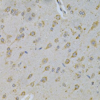 Immunohistochemistry - PSAP Antibody (144-01819)