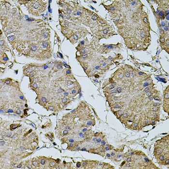 Immunohistochemistry - CPOX antibody (144-03807)
