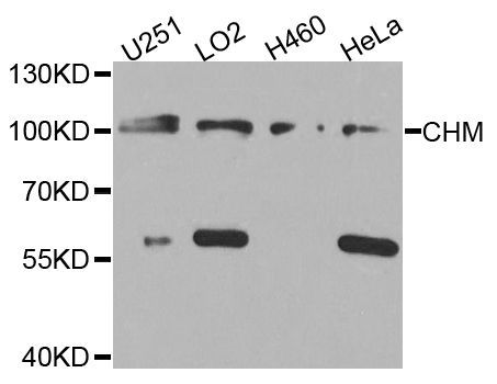 Western blot - CHM antibody (144-08345)