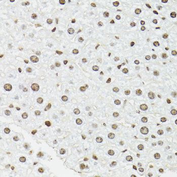 Immunohistochemistry - EDF1 Polyclonal Antibody (144-02283)