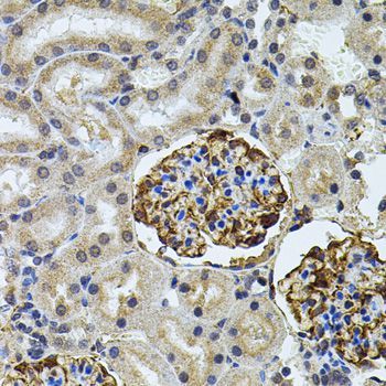 Immunohistochemistry - CETP antibody (144-01355)