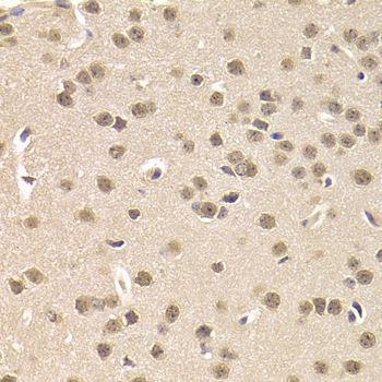 Immunohistochemistry - [KO Validated] CSNK1E Polyclonal Antibody (144-01796)