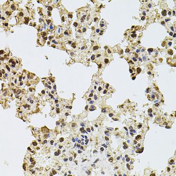 Immunohistochemistry - ZNF408 antibody (144-08512)