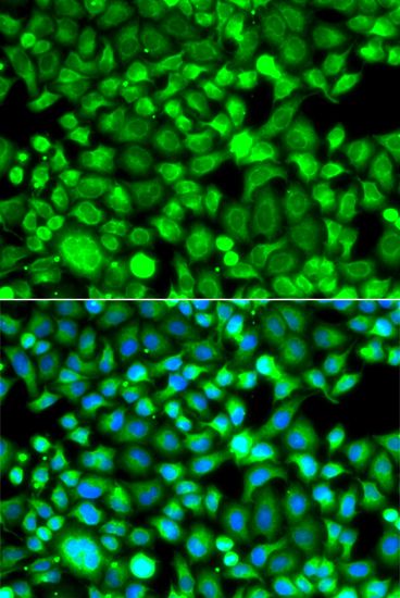 Immunofluorescence - PSMB8 antibody (144-07340)