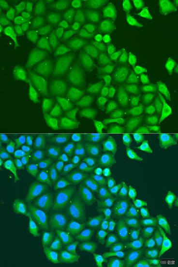 Immunofluorescence - HAUS6 antibody (144-04797)