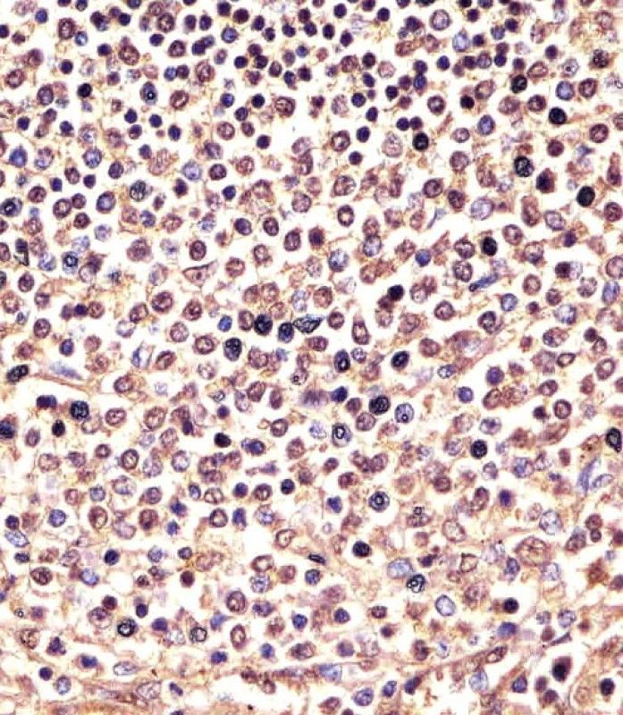 IHC-P