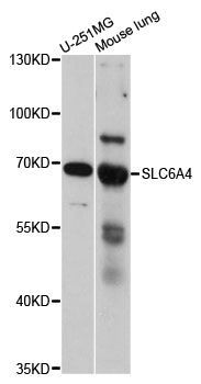 Western blot - SLC6A4 antibody (144-60594)