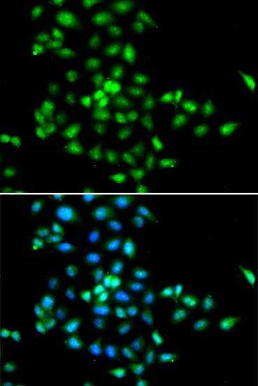 Immunofluorescence - SBDS antibody (144-05876)