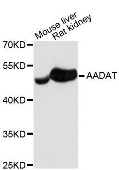 Western blot - AADAT antibody (144-013090)