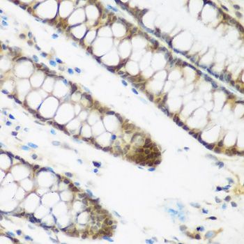 Immunohistochemistry - NCBP2 antibody (144-07293)