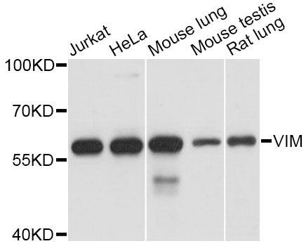 Western blot - VIM Polyclonal Antibody (144-011952)
