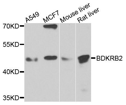 Western blot - BDKRB2 antibody (144-02844)