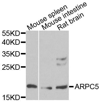 Western blot - ARPC5 antibody (144-08571)