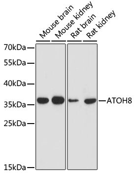 Western blot