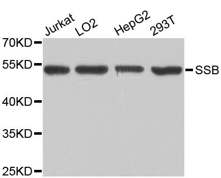 Western blot - SSB Polyclonal Antibody (144-00630)