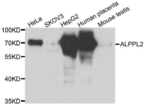 Western blot - ALPPL2 antibody (144-06866)