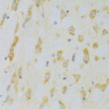 Immunohistochemistry - CASP9 Antibody (144-02636)