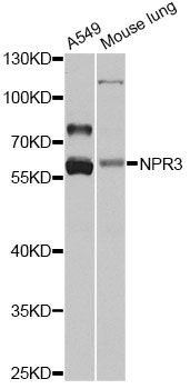 Western blot - NPR3 antibody (144-08138)