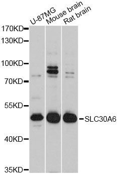Western blot - SLC30A6 Antibody (144-011644)