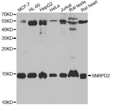 Western blot - SNRPD2 Polyclonal Antibody (144-06983)