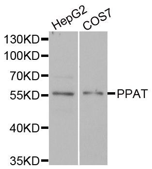 Western blot - PPAT antibody (144-06698)