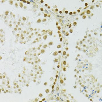 Immunohistochemistry - ADAR Polyclonal Antibody (144-07869)
