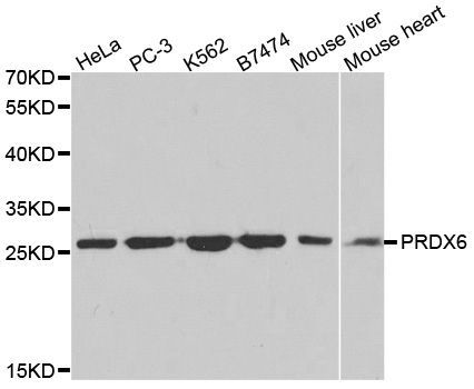 Western blot - PRDX6 antibody (144-02031)