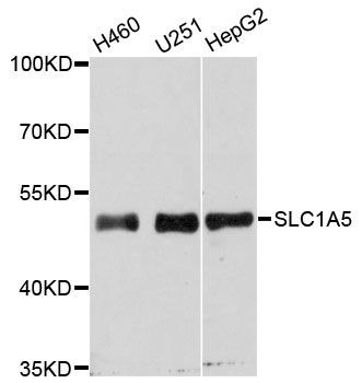 Western blot - SLC1A5 antibody (144-06981)