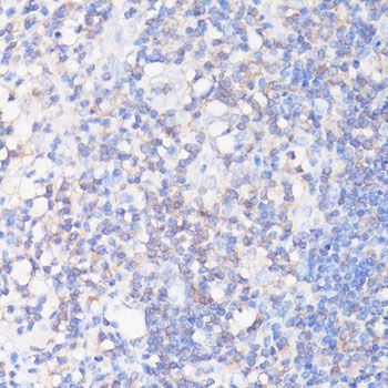 Immunohistochemistry - CFL1 antibody (144-01704)