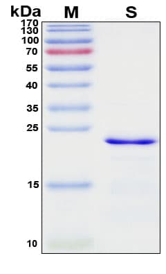 SDS-PAGE Image