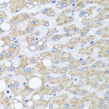 Immunohistochemistry - SRI antibody (144-06751)