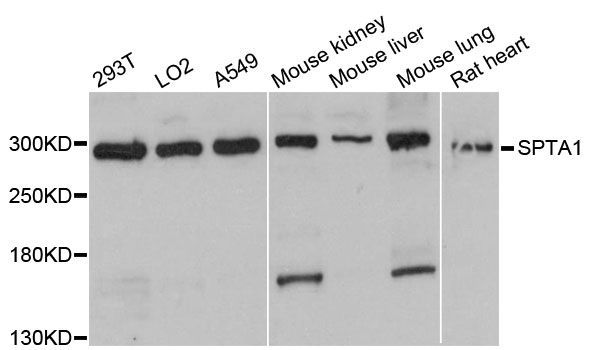 Western blot - SPTA1 antibody (144-12355)