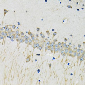 Immunohistochemistry - SERPINA4 Polyclonal Antibody (144-07320)