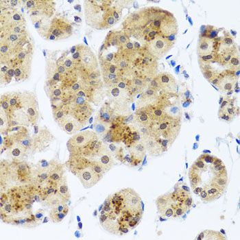 Immunohistochemistry - RAD23B Polyclonal Antibody (144-01034)