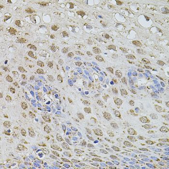 Immunohistochemistry - PLK4 antibody (144-09863)