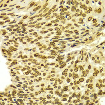 Immunohistochemistry - Lamin A/C Polyclonal Antibody (144-00249)